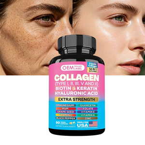 Cápsulas de Colágeno Múltiple de Marca Privada 14 en 1 con 10000mcg de Biotina, Queratina y Ácido Hialurónico para Cabello, Piel y Uñas - Product Image 1