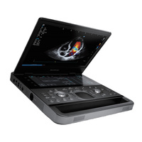 Sistema de Ultrasonido Veterinario de Alta Gama Sonoscape ProPet X10/E10, Resolución de Imagen Superior, Claridad, Reutilizable, Duradero, Fácil de Usar