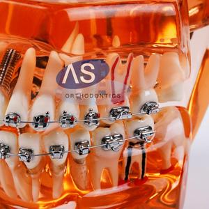 วัสดุสิ้นเปลืองทางทันตกรรม  ขายึดโลหะสำหรับจัดฟัน - Product Image 5