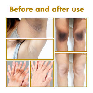 Huile exfoliante noire pour l'acanthosis, éclaircissante pour les aisselles, les genoux, les mains, les coudes, les articulations, peeling pour le corps, éclaircissant le teint, nourrissant, vitamine - Product Image 4