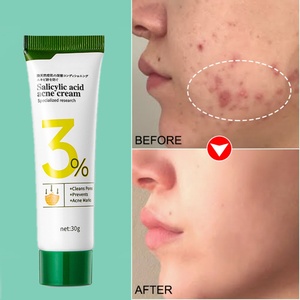 ครีมทาหน้าลดสิว 30 กรัม ราคาส่ง ราคาถูก ผสมกรดซาลิไซลิก ช่วยทำความสะอาดรูขุมขนและลดรอยสิว - Product Image 6