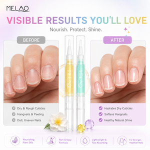 Set <span class=keywords><strong>de</strong></span> Lápices <span class=keywords><strong>de</strong></span> Aceite Hidratante para Cutículas <span class=keywords><strong>de</strong></span> Marca Blanca, Ligeros, No Grasosos, con Infusión <span class=keywords><strong>de</strong></span> <span class=keywords><strong>Plantas</strong></span> para el Cuidado Diario <span class=keywords><strong>de</strong></span> Manos y Uñas, Aceite Esencial - Product Image 5