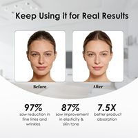 Eveekon 2026 Appareil de Lifting Anti-Âge Visage et Cou, Dissolvant de Rides, Outil de Beauté à Domicile, Vente Chaude