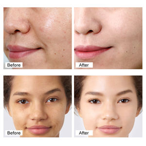 Crème hydratante pour le visage à l'huile de jojoba, au collagène et au rétinol 3% biologique naturel, marque privée, blanchissante, anti-rides, réparatrice - Product Image 5