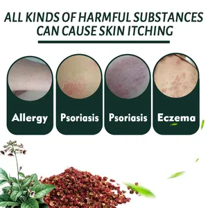 Krim Herbal OEM Populer untuk Eksim <span class=keywords><strong>Psoriasis</strong></span>, Salep Dermatitis untuk Penggunaan Luar, Plester Anti Gatal untuk Perawatan Kulit - Product Image 5
