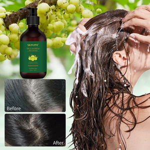 Nueva fábrica de spa para el cabello, mejora el control del aceite del cuero cabelludo, tratamiento de mascarilla para el cabello, esencia <span class=keywords><strong>Rogaine</strong></span>, antipérdida, juego de champú con aceite Amla - Product Image 5