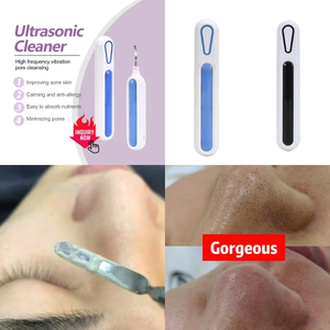 Nettoyant exfoliant <span class=keywords><strong>pour</strong></span> <span class=keywords><strong>le</strong></span> <span class=keywords><strong>visage</strong></span> à vibrations haute fréquence, nettoyage en profondeur, élimination des points noirs, exfoliation, réduction des pores et rajeunissement de la peau - Product Image 5