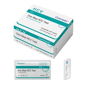 Test de diagnostic antigénique VIH <span class=keywords><strong>1</strong></span>/<span class=keywords><strong>2</strong></span> de qualité médicale, emballé pour une confidentialité accrue, pour des résultats rapides et précis, instrument d'analyse clinique - Product Image 5