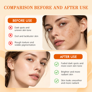 Crème Visage Éclaircissante Disaar en Gros à la Vitamine C pour Réparer les Taches Brunes, Atténue les Taches Solaires et les Taches de Vieillesse, à l'Huile de Rose Musquée, 50g, Approvisionnement en Gros - Product Image 6