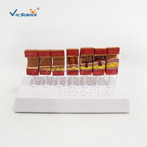 Modèle de Lésion Arthrosclérosique de l'Artère en PVC, Spécimen Anatomique Pédagogique pour la <span class=keywords><strong>Pathologie</strong></span> <span class=keywords><strong>Vasculaire</strong></span> - Product Image 4