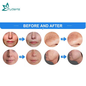 Salon sử dụng Hydra máy/nước dermabrasion máy bay phản lực Peel Facial máy 12 in1/13in 1/14 trong 1 Hydra dermabrasion máy trên khuôn mặt - Product Image 6