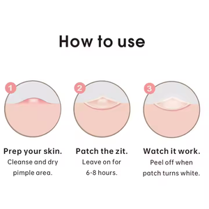 Atacado Microneedle Acne Patch Ácido Hialurônico Acne Patch para cura rápida - Product Image 6