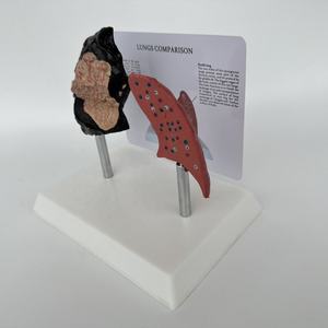 Modelo de patología pulmonar humana para ciencias médicas: modelo de enfermedad pulmonar, modelo de enfermedad orgánica, modelo antidrogas - Product Image 3