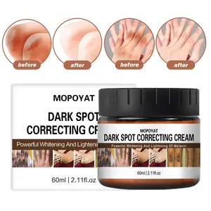 Extreme Whitening Anti Donkere Vlek Veroudering Rimpel Knieën Ellebogen Sterke Vitamine Witte Lotion Gezicht Body Whitening Cream