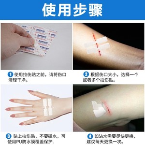 Pansement adhésif médical pour réduire la tension des plaies cutanées, pansement sans suture, pansement à fermeture éclair pour les cicatrices chirurgicales des enfants. - Product Image 4