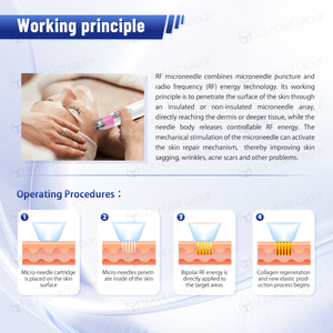 Macchina frazionaria/microneedling di microneedle rf della macchina di radiofrequenza approvata CE - Product Image 5