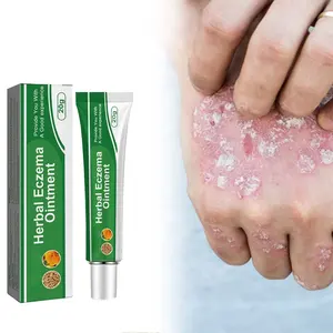 Psoriasi unguento a base di erbe acne dermatite scroto eczema pitiriasi orticaria psoriasi crema per la cura della pelle prodotti