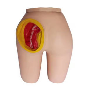 Gelsonlab HSBMY-074 Kniegewricht Intracavitaire Injectie Model - Product Image 4