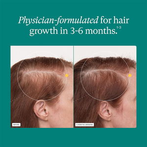 Suplementos para el Crecimiento del Cabello para Mujeres OEM, Biotina, Queratina Bioactiva, Extracto Herbal en Cápsulas, Envasado al Vacío en Agua, Cultivo Silvestre - Product Image 4