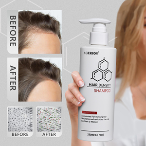 شامبو مضاد لتساقط الشعر يحتوي على مزيج من نخيل الساو باليمتو وزيت بذور اليقطين لمنع DHT، وتغذية بصيلات الشعر وتحفيز نمو شعر جديد - Product Image 1