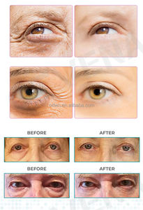 OEM ODM – crème pour les yeux, élimination des cernes sous les yeux, marque privée - Product Image 6