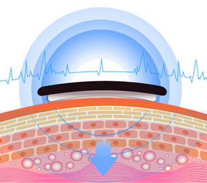 En forma de U de Control remoto Mini eléctrico portátil inalámbrico pulso vibrante inteligente cuello masajeador - Product Image 4