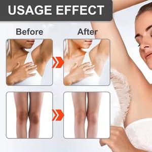 Crema blanqueadora instantánea para niña blanca, crema blanqueadora para el área íntima, crema blanqueadora para la piel, crema blanqueadora para rodillas, piernas, cuello, parte privada - Product Image 5