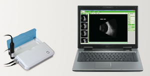 Échographe vétérinaire ophtalmique A/B SP-2000 – Équipement de diagnostic AB Scan pour ophtalmologie et biométrie oculaire - Product Image 6