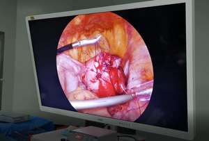 Macchina per endoscopio medico 1080p macchina per cistoscopio urologia chirurgia laparoscopica torre - Product Image 5