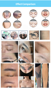 Machine neuve pour l'élimination des tatouages, trois longueurs d'onde 1064/532/1320 nm, pour l'élimination des sourcils, usage en salon. - Product Image 5