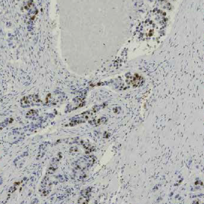 digital pathology slide scanner