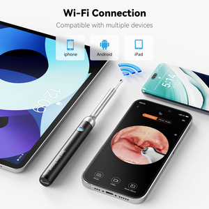 R1 nhà sản xuất bán buôn Intra miệng máy ảnh Intra miệng máy ảnh tiêu chuẩn 10MP intraoral wifi không dây intraoral máy ảnh Intra Miệng - Product Image 6