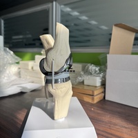 Zhizao 2026 Nouveau Modèle de Prothèse de Genou Articulée Amovible, Ensemble de Modèles d'Implant de Genou Double Argenté de Petite Taille