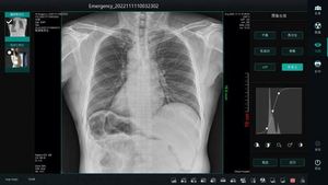 Abordable 14*17/17*17 <span class=keywords><strong>Rx</strong></span> Portatil X-ray Machine Digital X-ray Flat Panel Detector X-ray - Product Image 4