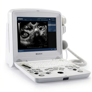 Échographe portable noir et blanc Edan DUS 60 VET avec Doppler PW pour diagnostic vétérinaire - Product Image 1