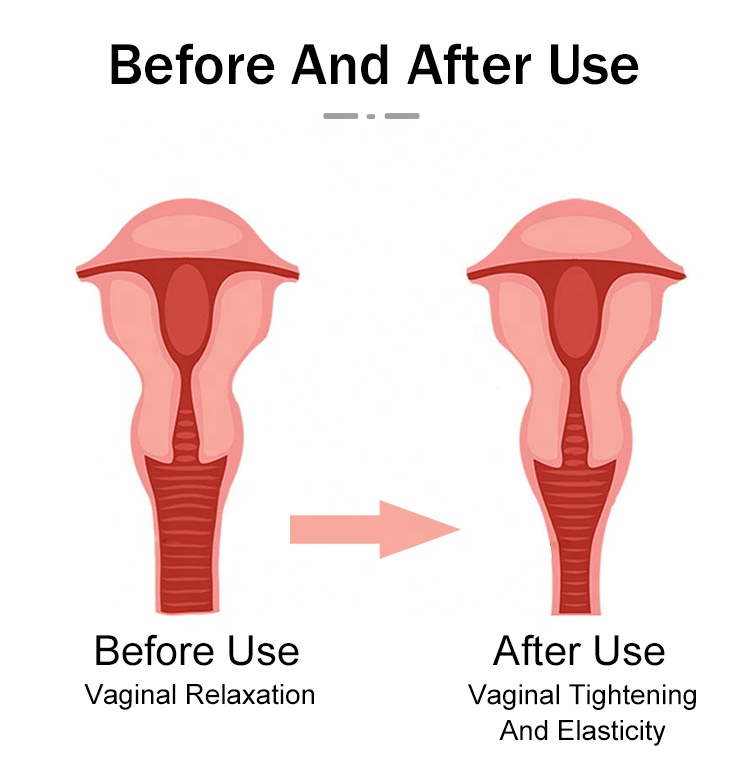 Reychel Stilni tomosha qiling Uysizlar bilan onlayn porno