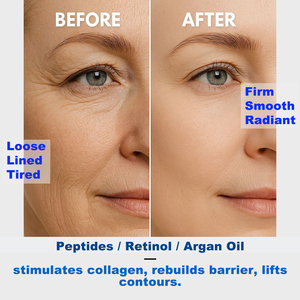 Suero y Aceite Facial con Retinol para Arrugas Profundas, Líneas Finas y Textura Áspera - Fórmula de Doble Capa con Aceite Antienvejecimiento - Product Image 3