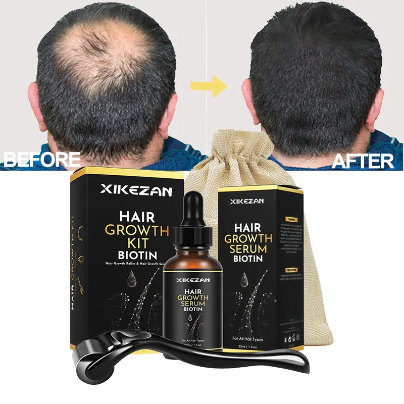 Meilleur soin des cheveux huile traitement anti-perte biotine naturelle repousse rapide cheveux endommagés sérum organique Derma Roller Kit sérum de croissance des cheveux
