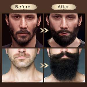 Une marque privée favorise la croissance <span class=keywords><strong>de</strong></span> barbes plus épaisses L'<span class=keywords><strong>huile</strong></span> à <span class=keywords><strong>barbe</strong></span> <span class=keywords><strong>pour</strong></span> hommes restaure les barbes à leur <span class=keywords><strong>meilleur</strong></span> état - Product Image 2