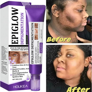 Crème de soins de la peau pour blanchir les taches de rousseur élimination de la pigmentation réparation rapide de la mélanine éclaircir la niacinamide livraison directe - Product Image 1