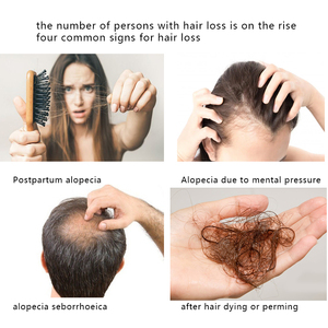 FirstSun Anti-Hair Loss Serum Hair Tonic Spray Tonic ayuda a <span class=keywords><strong>la</strong></span> <span class=keywords><strong>pérdida</strong></span> total del cabello de <span class=keywords><strong>la</strong></span> barba y restaura <span class=keywords><strong>la</strong></span> calvicie - Product Image 2