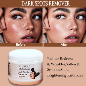 フェイスホワイトニングブリーチングピンプルダークスポットコレクター修正グローセラムリムーバーリムービングクリームボディローションソープスキンケアセット - Product Image 3