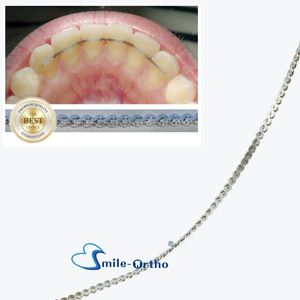 Retenue linguale <span class=keywords><strong>de</strong></span> rétention dentaire ortho s'adapte à la rétention <span class=keywords><strong>de</strong></span> l'anatomie des dents Confort du patient <span class=keywords><strong>Fil</strong></span> <span class=keywords><strong>de</strong></span> chaîne <span class=keywords><strong>de</strong></span> retenue en acier inoxydable - Product Image 6