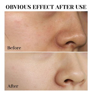 Etiqueta privada Beta-Glucan Power Vegan Serum Humedad profunda Célula Regeneradora Lifting Pore Shrinking Blanqueamiento para seco Maduro - Product Image 4
