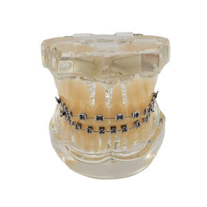Modelo de Ortodoncia Typodont para Educación Dental con Brackets Metálicos y 28 Piezas Dentales - Product Image 2