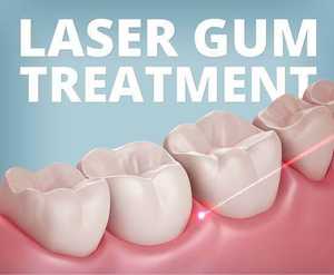 Mesin operasi tisu lembut pemotong Oral <span class=keywords><strong>Laser</strong></span> Diode 980nm 1470nm peralatan <span class=keywords><strong>Laser</strong></span> Gigi medis untuk gingivektomi - Product Image 5