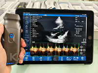 Sonda de Ultrasonido Inalámbrica Portátil a Color para Veterinaria, Transductor de Ultrasonido de Matriz de Fase para Uso Veterinario