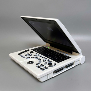 Machine à ultrasons couleur Portable, meilleur <span class=keywords><strong>prix</strong></span> ordinateur Portable couleur Doppler <span class=keywords><strong>Echo</strong></span> Machine pour humain - Product Image 3