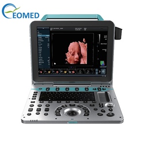 Appareil de diagnostic ultrasonore Doppler couleur 5D portable EO-P50, machine à ultrasons numérique, machine à ultrasons médicale - Product Image 1