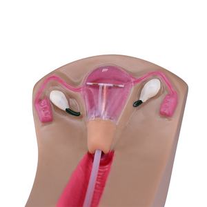 Simulador Avançado de Dispositivo Intrauterino (DIU) para Treinamento Feminino - Product Image 2